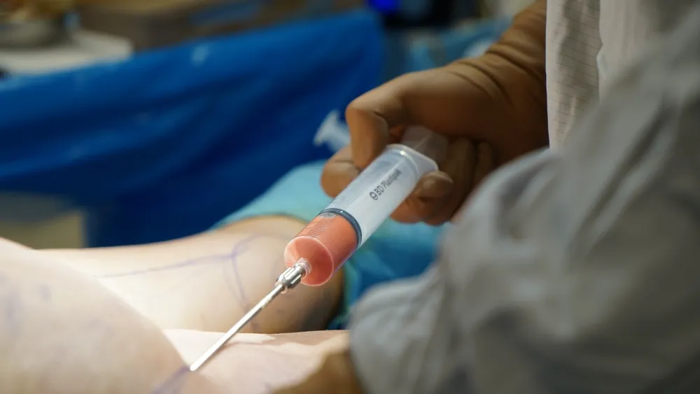 تزریق چربی در افراد پرریسک؛ ممنوعیت‌ها و نکات ضروری
