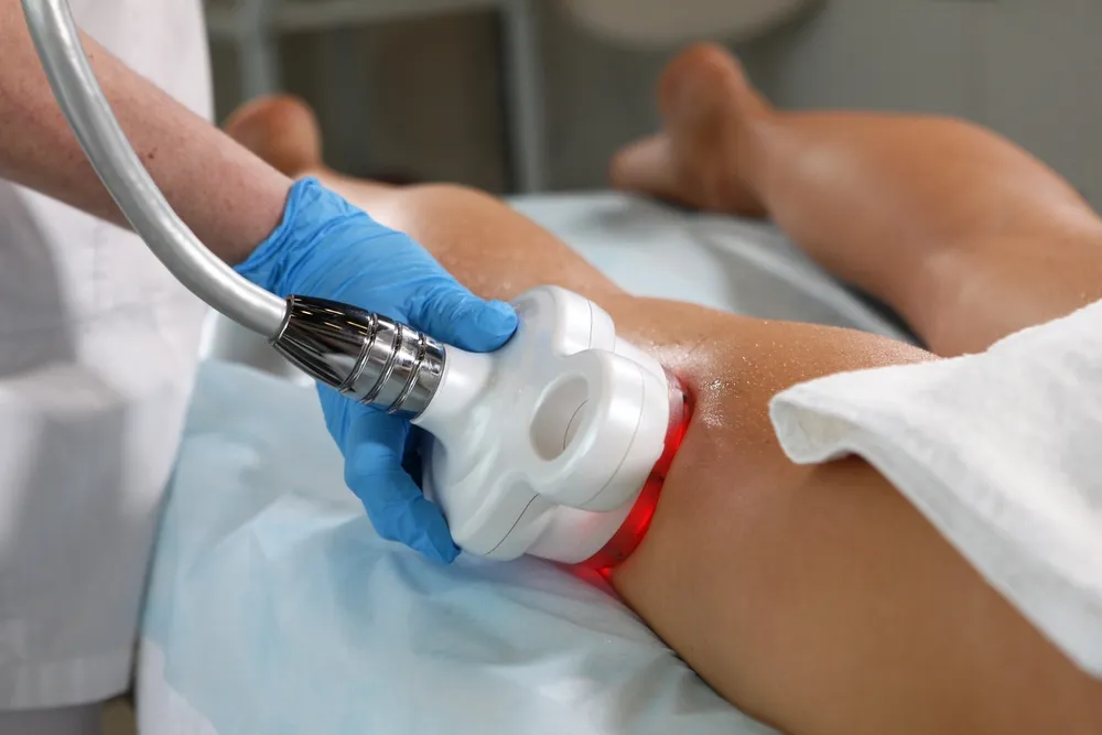 RF یا رادیو فرکانسی: فرمدهی و کاهش سایز با امواج گرمایی