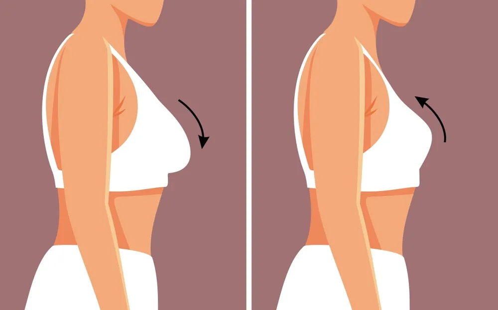 مراقبتهای کلیدی پیش از انجام لیفت سینه با نخ