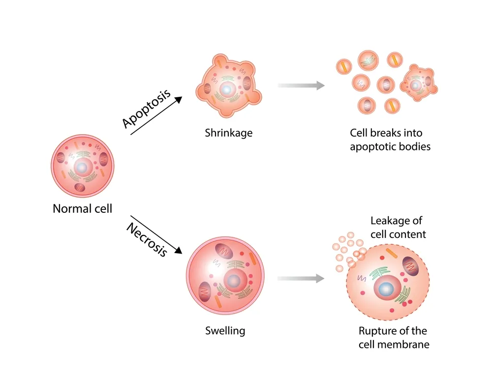 تشخیص نکروز سینه با روشهای تخصصی پزشکی