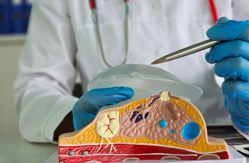 نقاهت ماموپلاستی: از مراقبت تا بهبودی کامل