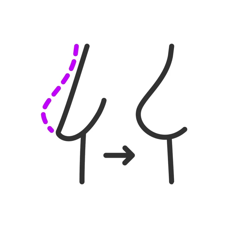 لیفت سینه با نخ: از سازوکار تا اثرگذاری