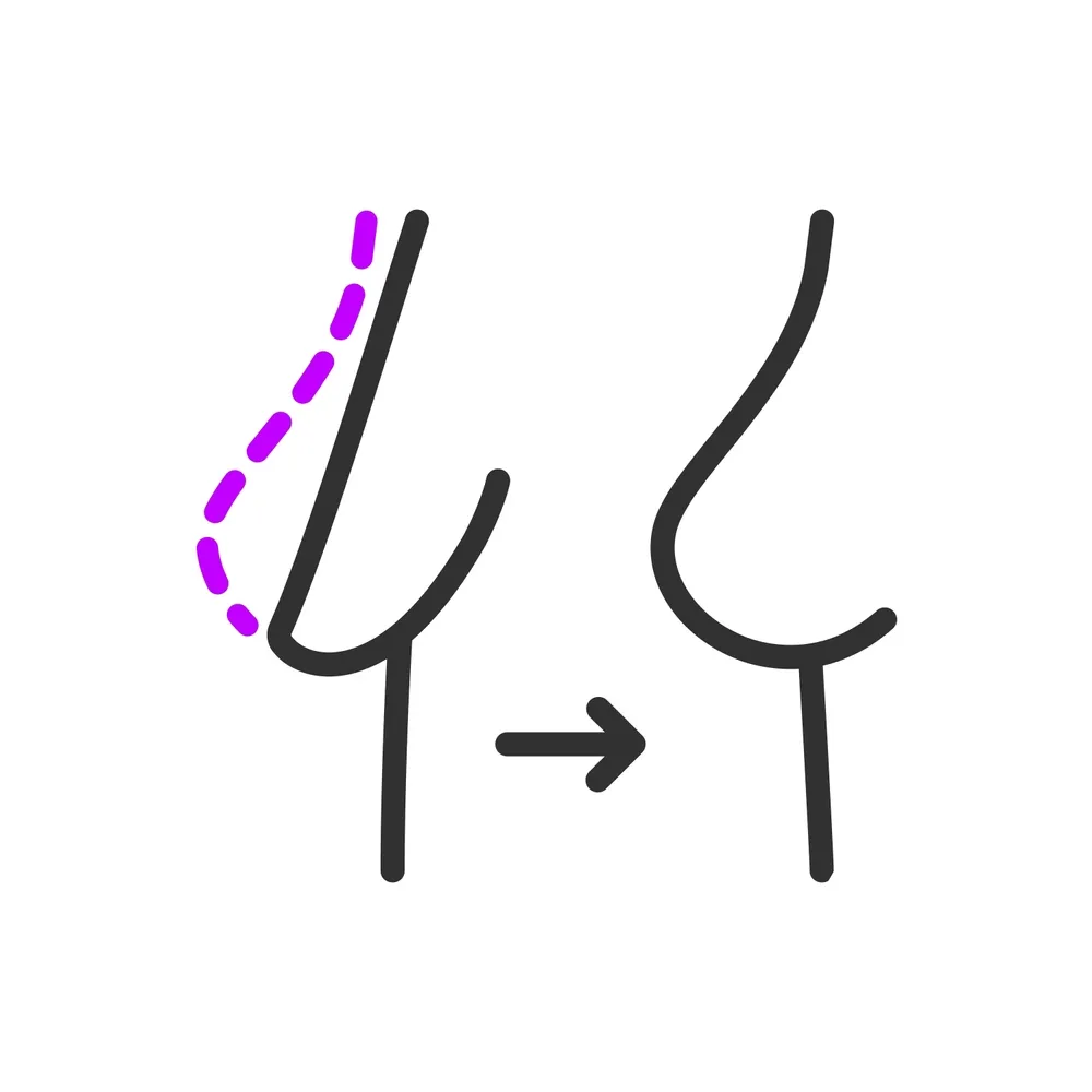 لیفت سینه با نخ: از سازوکار تا اثرگذاری