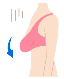 لیفت سینه با طب سنتی: از اثر گذاری تا ماندگاری