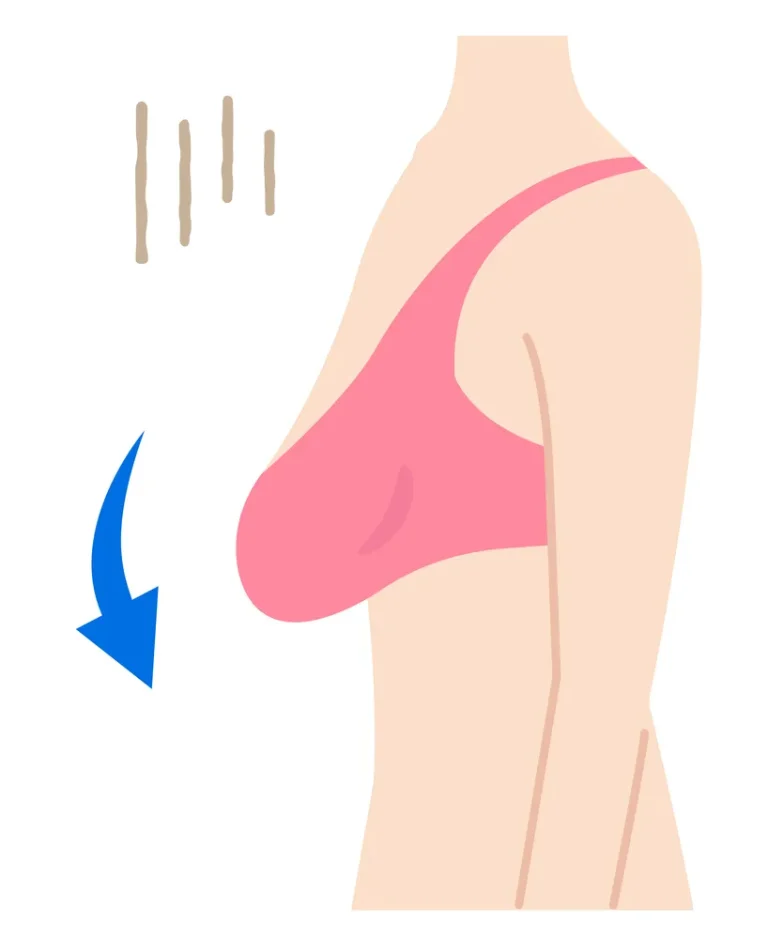 لیفت سینه با طب سنتی: از اثر گذاری تا ماندگاری