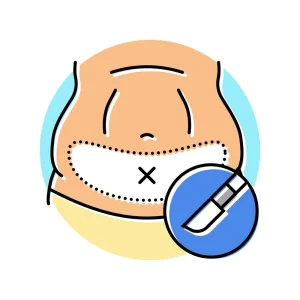 لیپو ابدومینوپلاستی